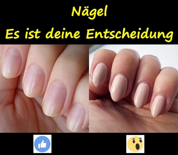 Nägel. Es ist deine Entscheidung.