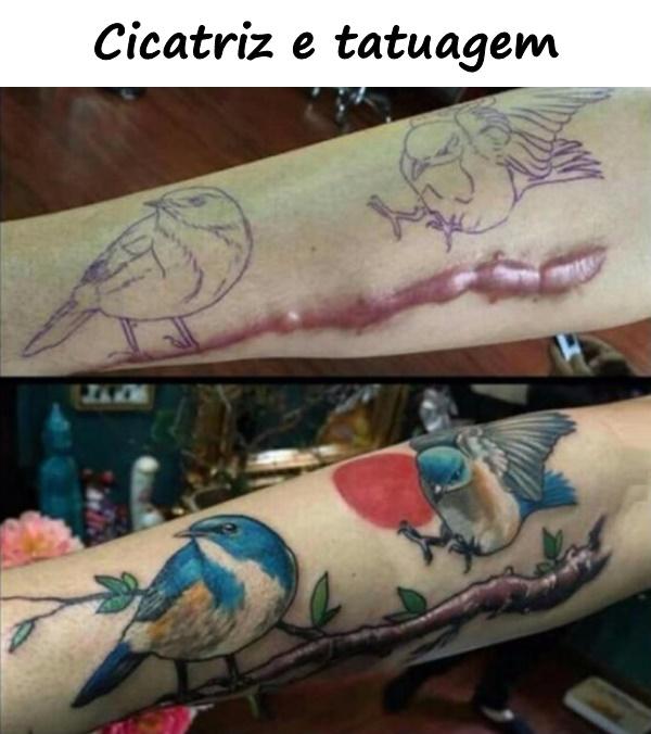 Cicatriz e tatuagem