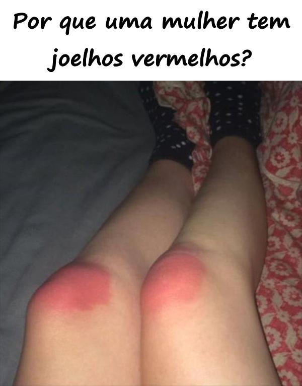 Por que uma mulher tem joelhos vermelhos?