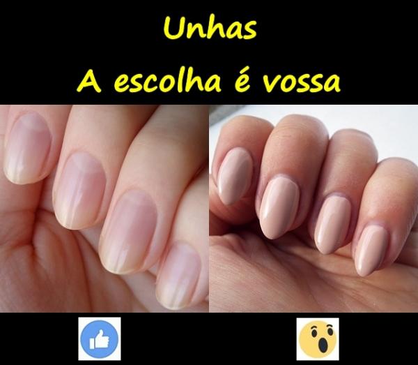 Unhas. A escolha é vossa.