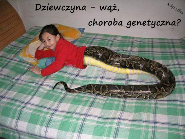 Dziewczyna - wąż, choroba genetyczna?